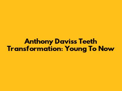 Anthony Davis's Teeth Transformation: Young To Now