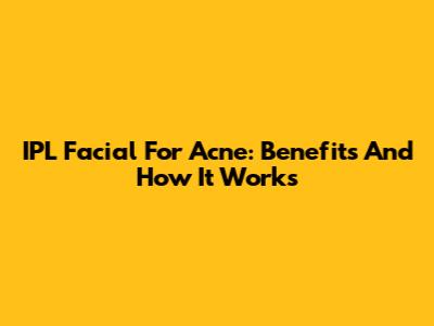 IPL Facial For Acne: Benefits And How It Works