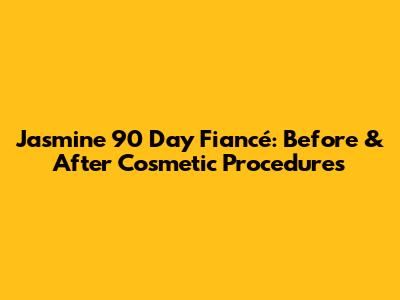 Jasmine 90 Day Fiancé: Before & After Cosmetic Procedures