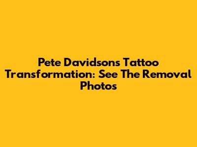 Pete Davidson's Tattoo Transformation: See The Removal Photos