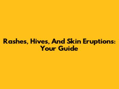 Rashes, Hives, And Skin Eruptions: Your Guide